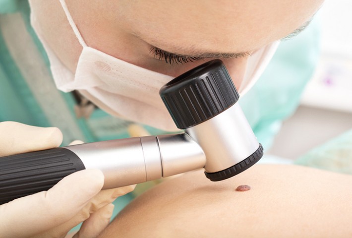 do you have a mole that needs to go | Form & Face