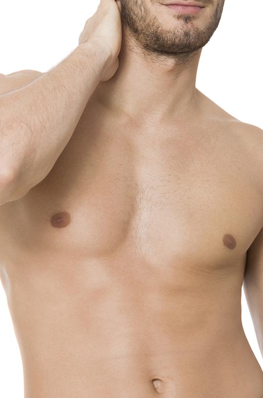 Surgery for gynaecomastia (male breast reduction) model 02-2, Form & Face Sydney, Dr Norris