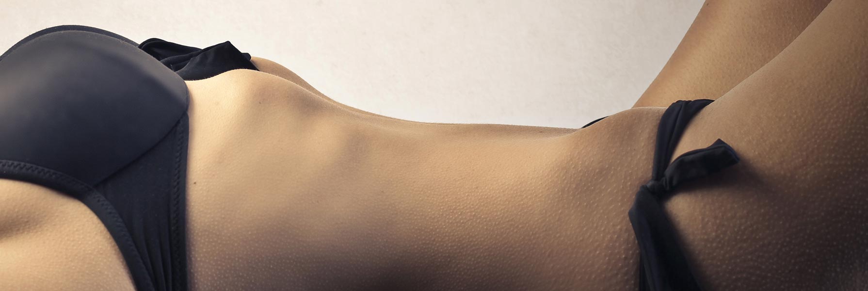 Liposculpture 2 Liposculpture (liposuction) model 03, Form & Face Sydney