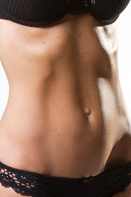 Liposculpture model 01, Form & Face Sydney