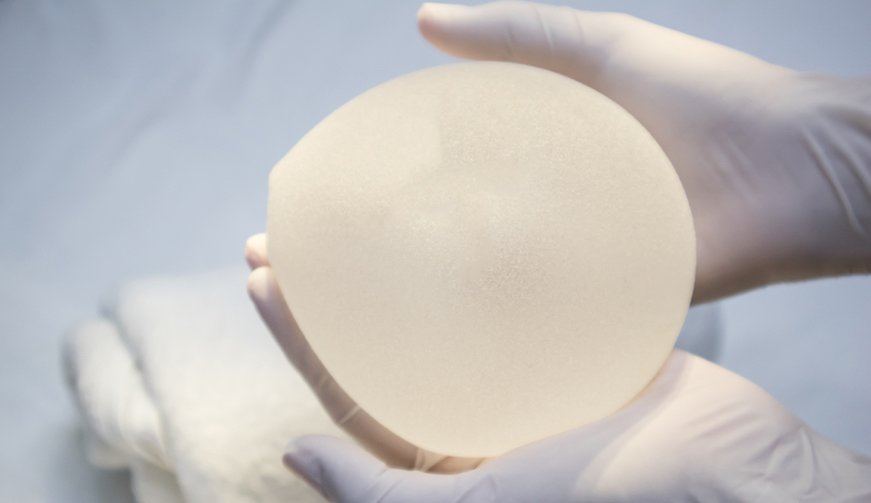 implant study finds odds of alcl cancer very low | Form & Face