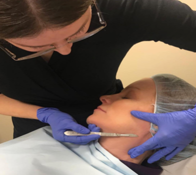 Epidermal levelling at Form & Face clinic in Sydney 01